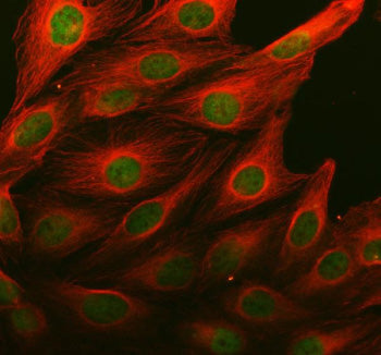 Immunofluorescent staining of MSL1 using anti-MSL1 antibody (green) and anti-Beta Tubulin antibody (