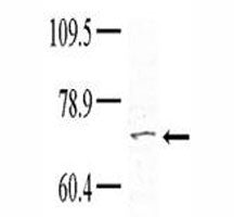 Western blot analysis of TNK1 antibody (1:100) in HeLa lysate; Courtesy of Dr. Richard Lu, Partners