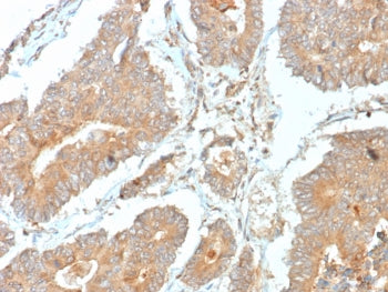 IHC staining of FFPE human prostate tissue with N-terminal EF-hand calcium binding protein 1 antibod
