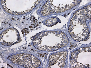 GSTM3 Antibody / Glutathione S-Transferase mu 3