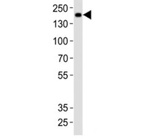 Mouse Insrr Antibody