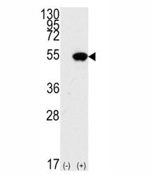 p53 Antibody