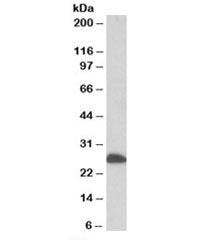 Western blot testing of human liver lysate with ETFB antibody at 0.1ug/ml. Predicted molecular weigh