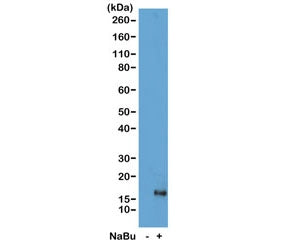 Western blot of acid extracts from HeLa cells untreated (-) or treated (+) with sodium butyrate usin