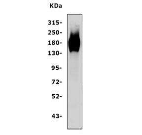 Western blot testing of human A431 cell lysate with EGFR antibody at 0.5ug/ml. Expected molecular we