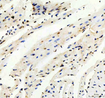 IHC staining of FFPE mouse heart tissue with TRIM63 antibody, HRP-secondary and DAB substrate. HIER: