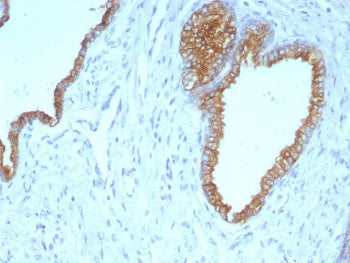 Cytokeratin 5/6 Antibody