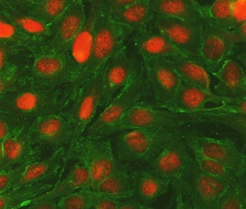 Immunofluorescent staining of FFPE human U-2 OS cells with Bcl-2 antibody (red) and Alpha Tubulin an