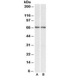 Western blot testing of human A) cerebellum and B) hippocampus lysate with Acetylcholinesterase anti