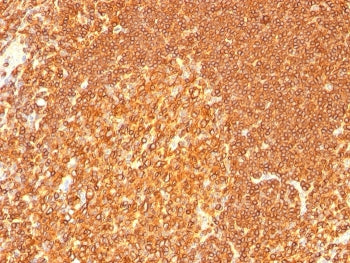 IHC: Formalin-fixed, paraffin-embedded human tonsil stained with HLA-DR antibody (LN3 + HLA-DRB/1067