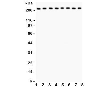 Western blot testing of Integrin alpha 5 antibody and Lane 1: rat brain; 2: mouse brain; 3: human MM
