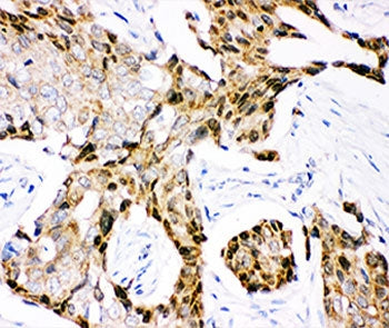 Ubiquitin Antibody