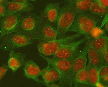 Immunofluorescent staining of FFPE human U-2 OS cells with SGTA antibody (red) and Alpha Tubulin ant