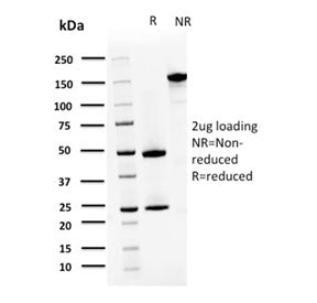 S100A4 Antibody / FSP1