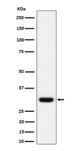 Western blot analysis of Adiponectin expression in human plasma lysate using ADIPOQ antibody.