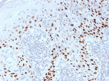 IHC staining of FFPE human cervix with p40 antibody. HIER: boil tissue sections in pH 9 10mM Tris wi