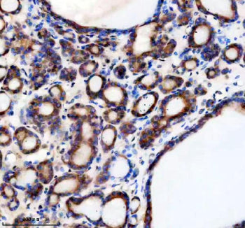 Immunohistochemical staining of TMED1 using anti-TMED1 antibody. TMED1 was detected in a paraffin-em