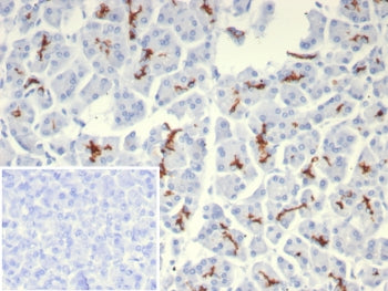 IHC staining of FFPE human pancreas tissue with CFTR antibody (clone rCFTR/8047). Inset: PBS used in