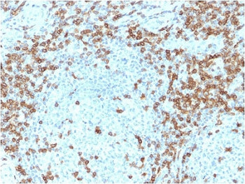 CD5 Antibody