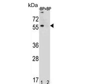Western blot testing of human MDA-MB453 lysate in the absence and presence of immunizing peptide, us