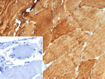 IHC staining of FFPE human skeletal muscle tissue with CA3 antibody (clone CA3/7885). Inset: PBS use