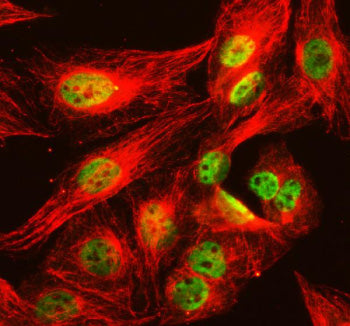 Immunofluorescent staining of NCOR2 using anti-NCOR2 antibody (green) and anti-Tubulin Alpha antibod