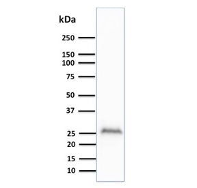 Western blot testing of human brain lysate with UchL1 antibody (clone UCHL1/841). Predicted molecula