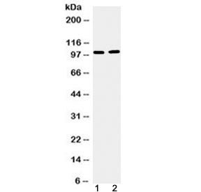Western blot testing of 1) mouse testis and 2) human U-87 MG cell lysate with TACC1 antibody at 0.5u