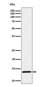 Western blot analysis of IL15 in Recombinant human IL-15 protein cell lysate.