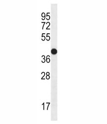 CD271 antibody western blot analysis in MDA-MB435 lysate. Predicted molecular weight ~45/75kDa (unmo