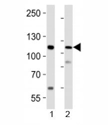 PRDM16 Antibody