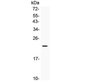 BMP4 Antibody / Bone morphogenetic protein 4
