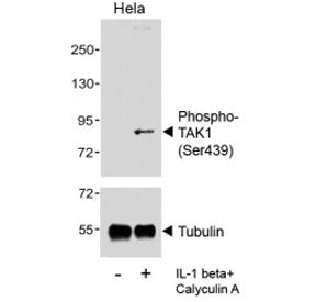 Western blot analysis of lysates from the human HeLa cell line, untreated or treated with IL-1beta (