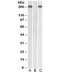 Western blot testing of HEK293 lysate overexpressing human THBS1-MYC with Thrombospondin antibody [1