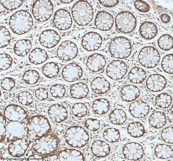 Immunohistochemical staining of MYH14 using anti-MYH14 antibody. MYH14 was detected in a paraffin-em