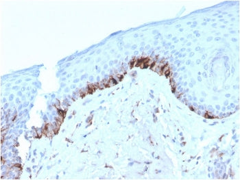 IHC staining of FFPE human skin with TRP1 antibody (clone TYRP1/3282). HIER: boil tissue sections in
