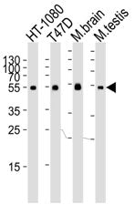 Tubulin alpha 6 Antibody (TUBA6)