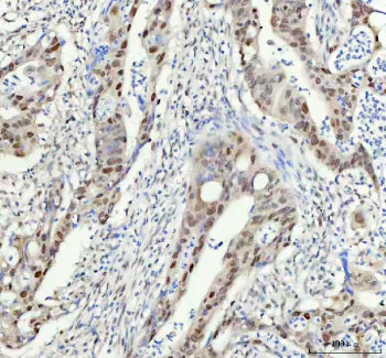 Immunohistochemical staining of FAM50A using anti-FAM50A antibody. FAM50A was detected in a paraffin