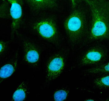 IF analysis of UBE4B using anti-UBE4B antibody (green). UBE4B was detected in an immunocytochemical