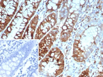 STMN1 Antibody / Stathmin 1