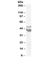 Western blot testing of human brain frontal cortex lysate with DYX1C1 antibody at 0.5ug/ml. Predicte