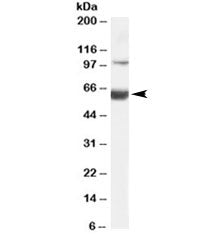 Western blot testing of human liver lysate with HNF1B antibody at 0.1ug/ml. Expected molecular weigh