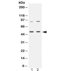 MAP3K8 Antibody