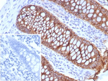 IHC staining of FFPE human colon tissue with LI Cadherin antibody (clone rCDH17/8514). Inset: PBS us