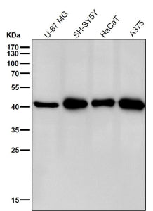 All lanes use the CABP1 antibody at 1:3K dilution for 1 hour at room temperature. Predicted molecula