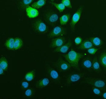 Immunofluorescent staining of SCD using anti-SCD1 antibody (green). SCD1 was detected in an immunocy