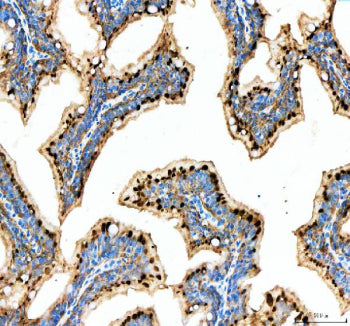 IHC staining of Mettl3 protein using Zebrafish Mettl3 antibody, HRP secondary and DAB substrate with