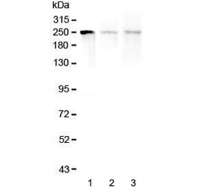 Western blot testing of 1) human SGC-7901, 2) rat spleen and 3) mouse spleen lysate with MYLK antibo