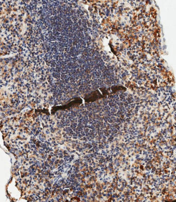 IHC staining of FFPE mouse spleen tissue with anti-TLR2 antibody. HIER: steam section in pH9 EDTA bu