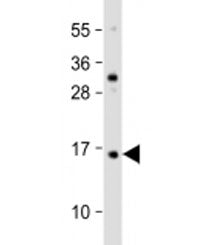 TCTA Antibody